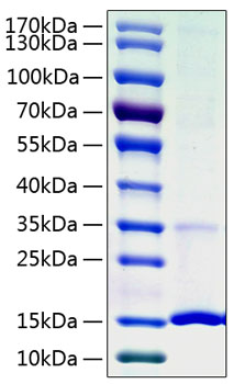 Recombinant Human Cystatin-S/CST4 Protein