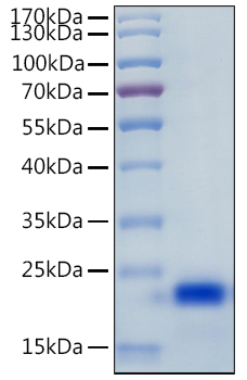 Recombinant Human IL-4 Protein