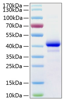 Recombinant Human IGF-I Protein