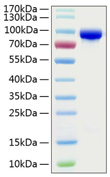 Recombinant Human Transferrin/TF Protein