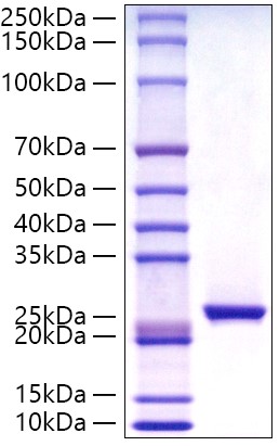 Recombinant Human C-Reactive Protein/CRP Protein