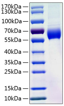 Recombinant Human Angiotensinogen/AGT Protein