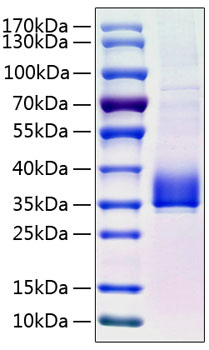 Recombinant Human Angiopoietin-like 3/ANGPTL3(17-220) Protein