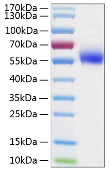 Recombinant Human IL-1R2/CD121b Protein