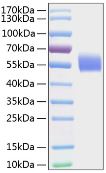 Recombinant Human IL-1R1/CD121a Protein