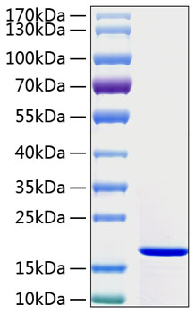 Recombinant Human IFN-gamma Protein