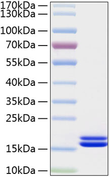 Recombinant Human IL-2 Protein