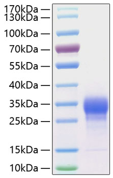 Recombinant Human IL-7 Protein