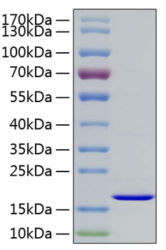 Recombinant Human FGF-2/bFGF Protein