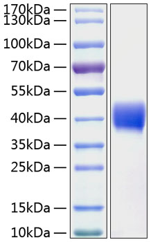 Recombinant Human Mesothelin/MSLN Protein