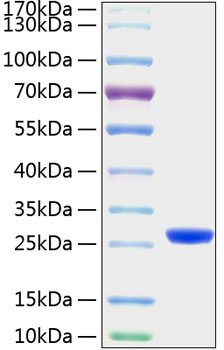 Recombinant Mouse Lipocalin-2/NGAL/LCN2 Protein