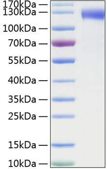 Recombinant Mouse E-selectin/SELE/CD62E Protein