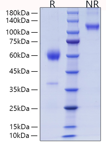 Recombinant Mouse Placenta growth factor/PlGF/PGF Protein