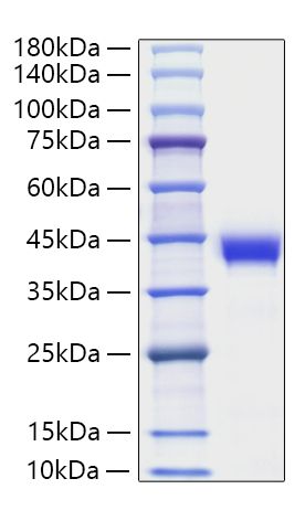 Recombinant Human Zinc-alpha-2-glycoprotein/AZGP1 Protein