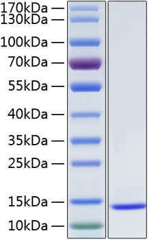 Recombinant Human Serum amyloid A-1/SAA1 Protein