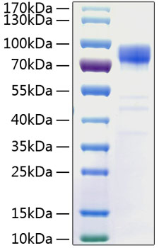 Recombinant Human PSD-95/DLG4 Protein