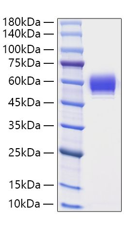 Recombinant Human Serpin B3/SCCA-1 Protein