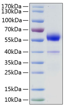 Recombinant Human VEGF-B/VEGF186 Protein