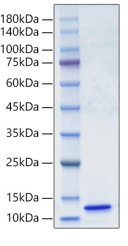 Recombinant Human Complement C5A Protein