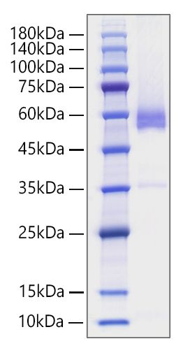 Recombinant Human TNFSF7/CD27 Ligand/CD70 Protein