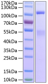 Recombinant Human IGF1R/CD221 Protein