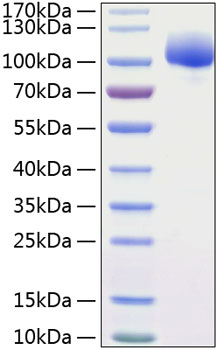 Recombinant Human FGFR-1/FLT-2/CD331 Protein