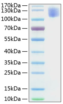 Recombinant Human CEACAM5/CEA/CD66e Protein