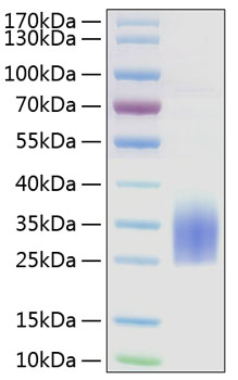 Recombinant Human TREM2 Protein