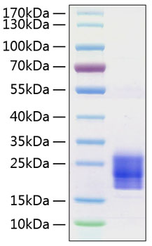 Recombinant Human/Mouse/Rat Irisin/FNDC5 Protein