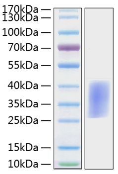 Recombinant Mouse PD-1/PDCD1/CD279 Protein