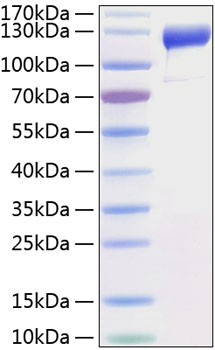 Recombinant Human VEGFR-1/FLT-1 Protein