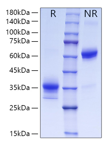 Recombinant Human LOX-1/OLR1 Protein