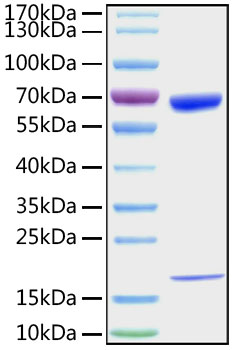 Recombinant Mouse PCSK9 Protein