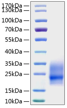 Recombinant Mouse CSF-2/GM-CSF Protein