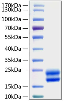 Recombinant Rat CSF-2/GM-CSF Protein