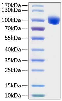 Recombinant Human ROR1 Protein