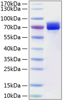 Recombinant Human Mesothelin/MSLN Protein