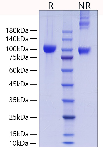 Recombinant Mouse MMP-9 Protein