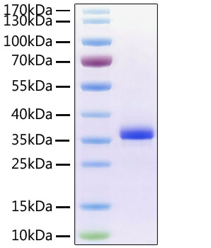 Recombinant Human Noggin/NOG Protein