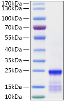 Recombinant Human GTPase KRas/KRAS(G12V) Protein