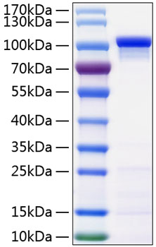 Recombinant Human Catenin beta-1/CTNNB1 Protein