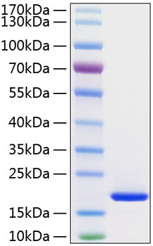 Recombinant Human FGF-1/aFGF Protein