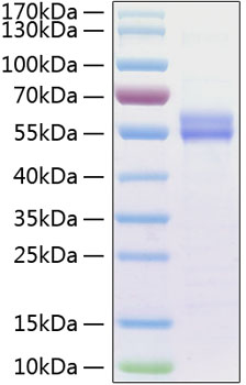 Recombinant Human IL-15 Protein