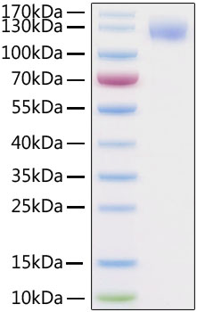 Recombinant SARS-CoV-2 Spike S1 Protein