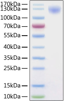 Recombinant SARS-CoV-2 Spike S1 Protein