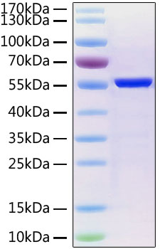 Recombinant SARS-CoV-2 Nucleocapsid Protein