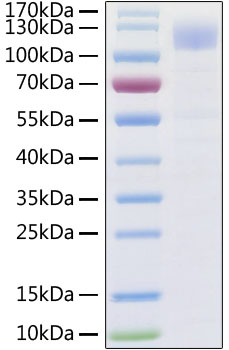 Recombinant SARS-CoV-2 Spike S1 Protein