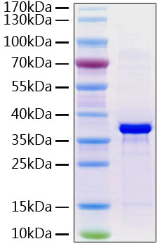 Recombinant Human Fibrinogen like 1/FGL1 Protein