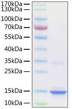 Recombinant Human S100-A9 Protein