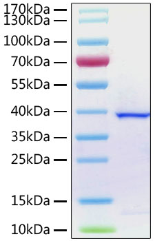 Recombinant SARS-CoV-2 papain-like protease Protein